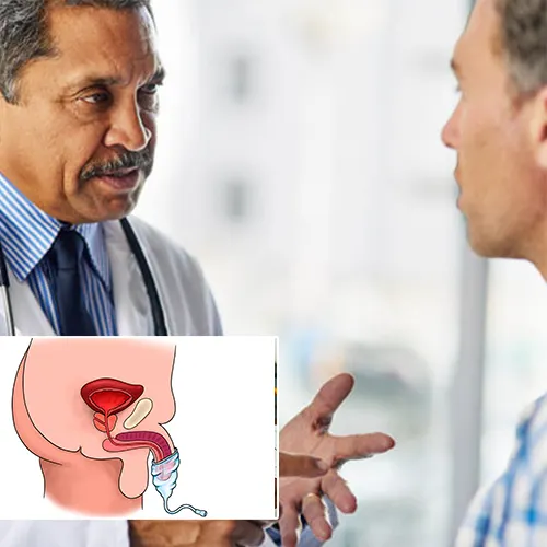 Welcome to   Wauwatosa Surgery Center

Your Comprehensive Guide to Choosing a Penile Implant