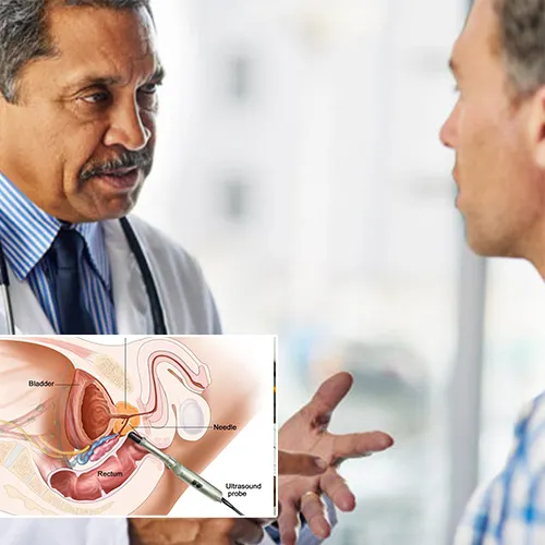 Choosing the Right Penile Implant with   Wauwatosa Surgery Center
