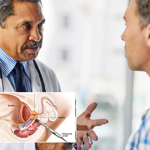 Welcome to   Wauwatosa Surgery Center 
: Your Guide to Penile Injection Therapy